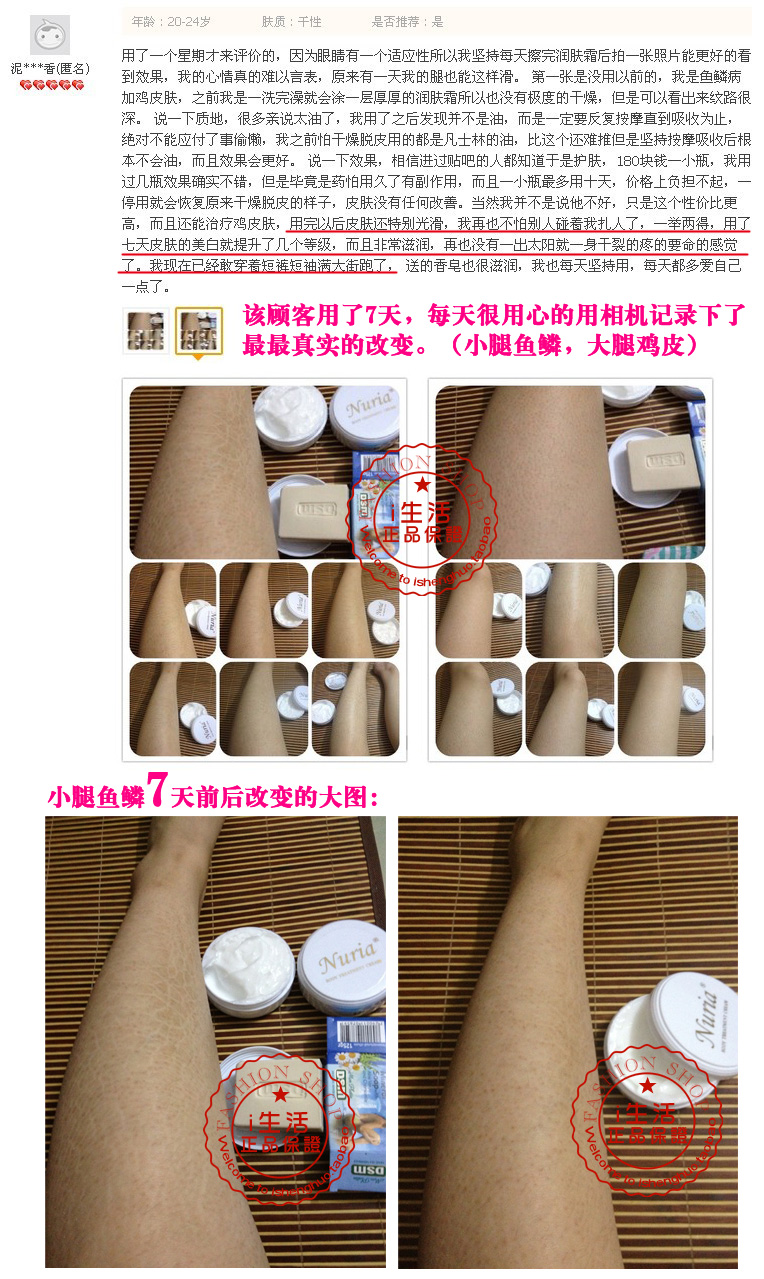 nuria纽瑞雅120g身体乳鱼鳞病去蛇鸡皮肤霜疙瘩毛囊炎毛周角化症